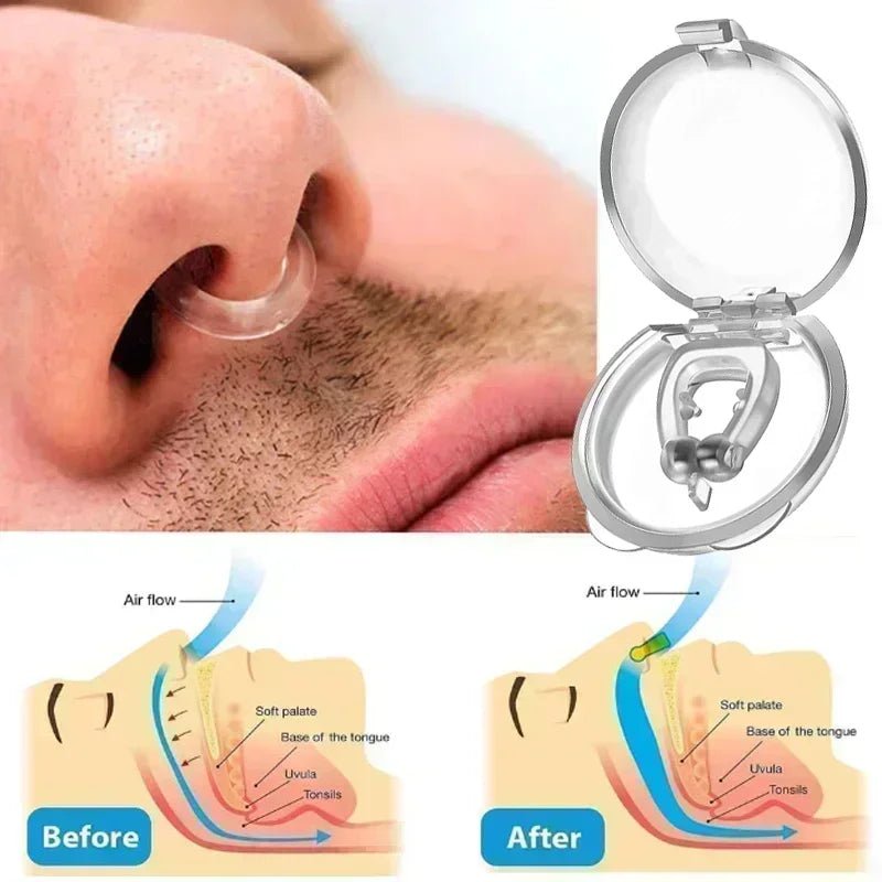 Anti-Snoring Corrector Snore Prevention Gadget Women's Anti-Snore Device Snore Elimination Nose Clip Men's Sleep Night - Too-Eazy